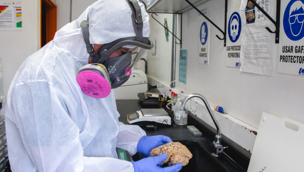 Hallazgo del biomarcador TSPO da nuevas pistas para la detección temprana del alzhéimer