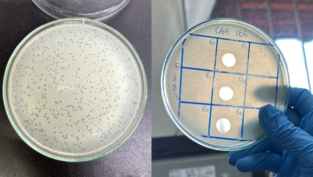 ¡Ellas están aquí! Superbacterias y fagos libran una batalla microscópica